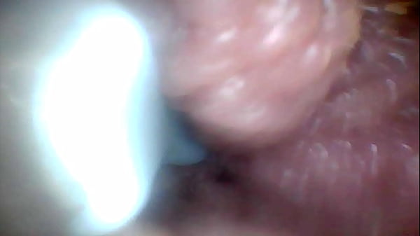 Endoscope camera shows the most sensitive parts of the penis Educational video